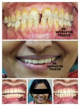 Slider image (3) Dr. Thakurs NexGen